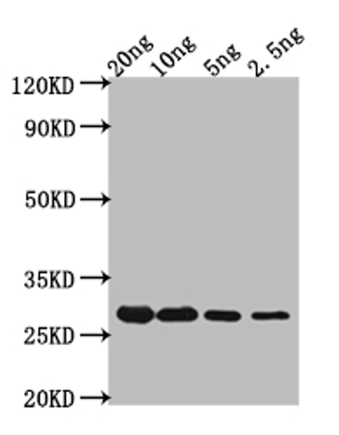 Western Blot. Positive WB detected in Recombinant protein. All lanes: CRTI antibody at 1:2000. Secondary. Goat polyclonal to rabbit IgG at 1/50000 dilution. Predicted band size: 24.2 kDa. Observed band size: 56 kDa. 