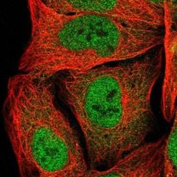 Immunocytochemistry/Immunofluorescence: MB21D1 Antibody [NBP1-86761] - Immunofluorescent staining of human cell line U-2 OS shows positivity in nucleus but not nucleoli.