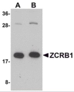 Western blot analysis of ZCRB1 in Raji cell lysate with ZCRB1 antibody at (A) 1 and (B) 2 &#956;g/mL.