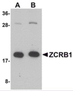 Western blot analysis of ZCRB1 in Raji cell lysate with ZCRB1 antibody at (A) 1 and (B) 2 μg/mL.