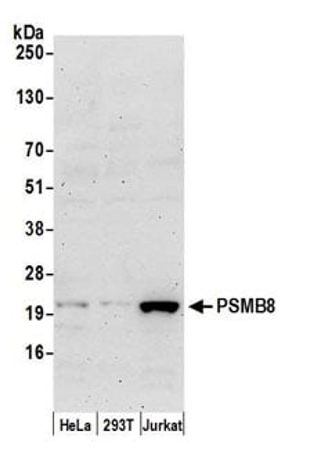 Detection of human PSMB8 by western blot.