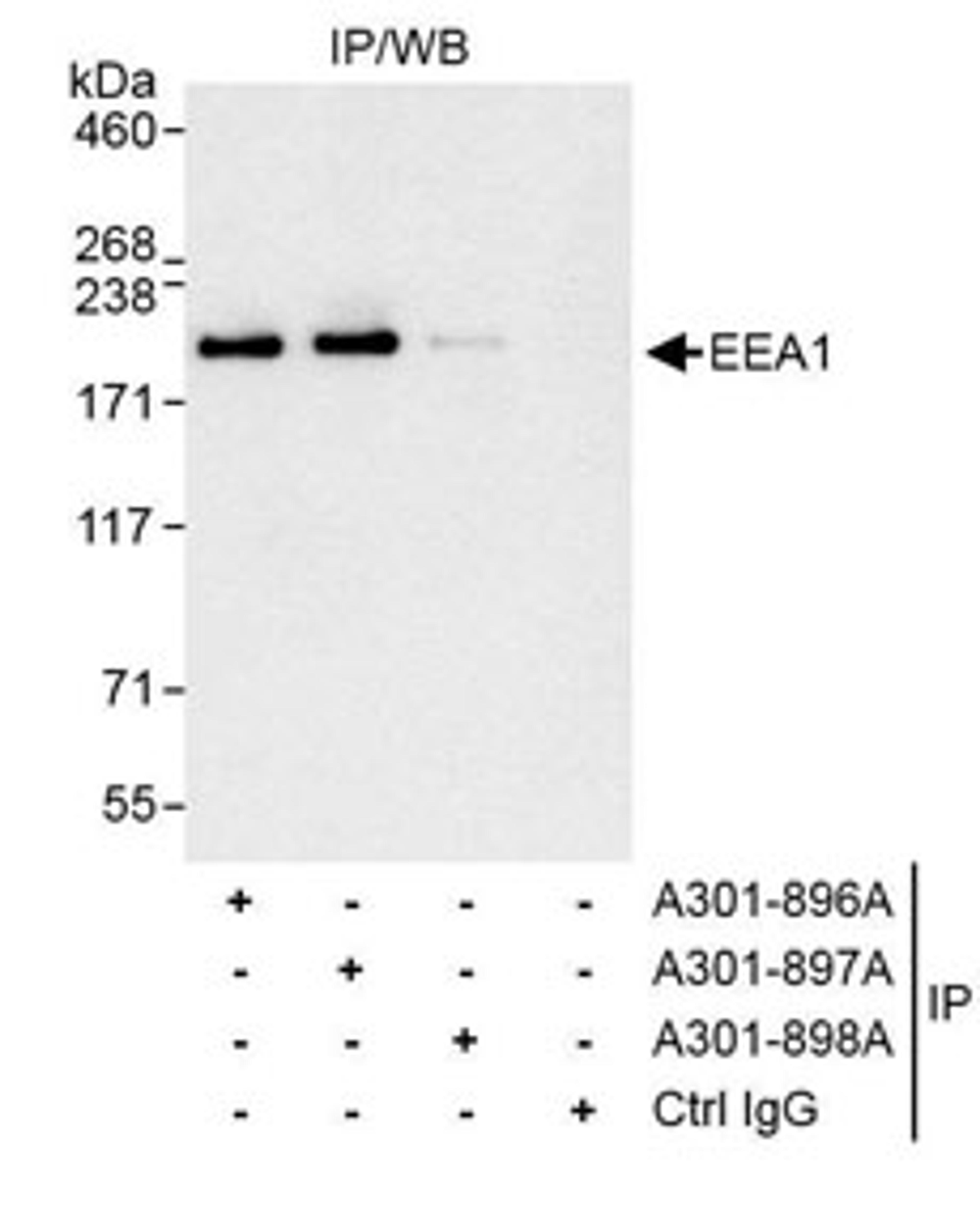 Detection of human EEA1 by western blot of immunoprecipitates.