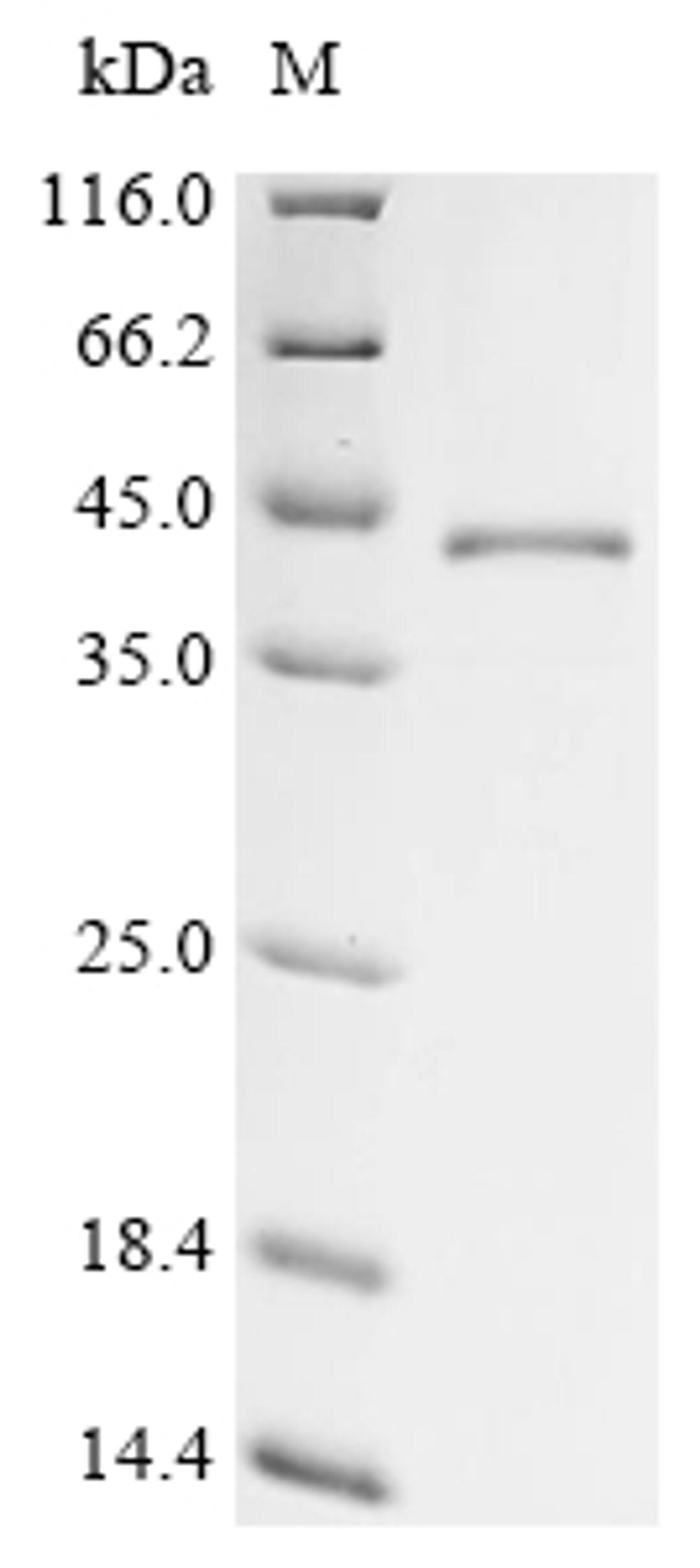 (Tris-Glycine gel) Discontinuous SDS-PAGE (reduced) with 5% enrichment gel and 15% separation gel.