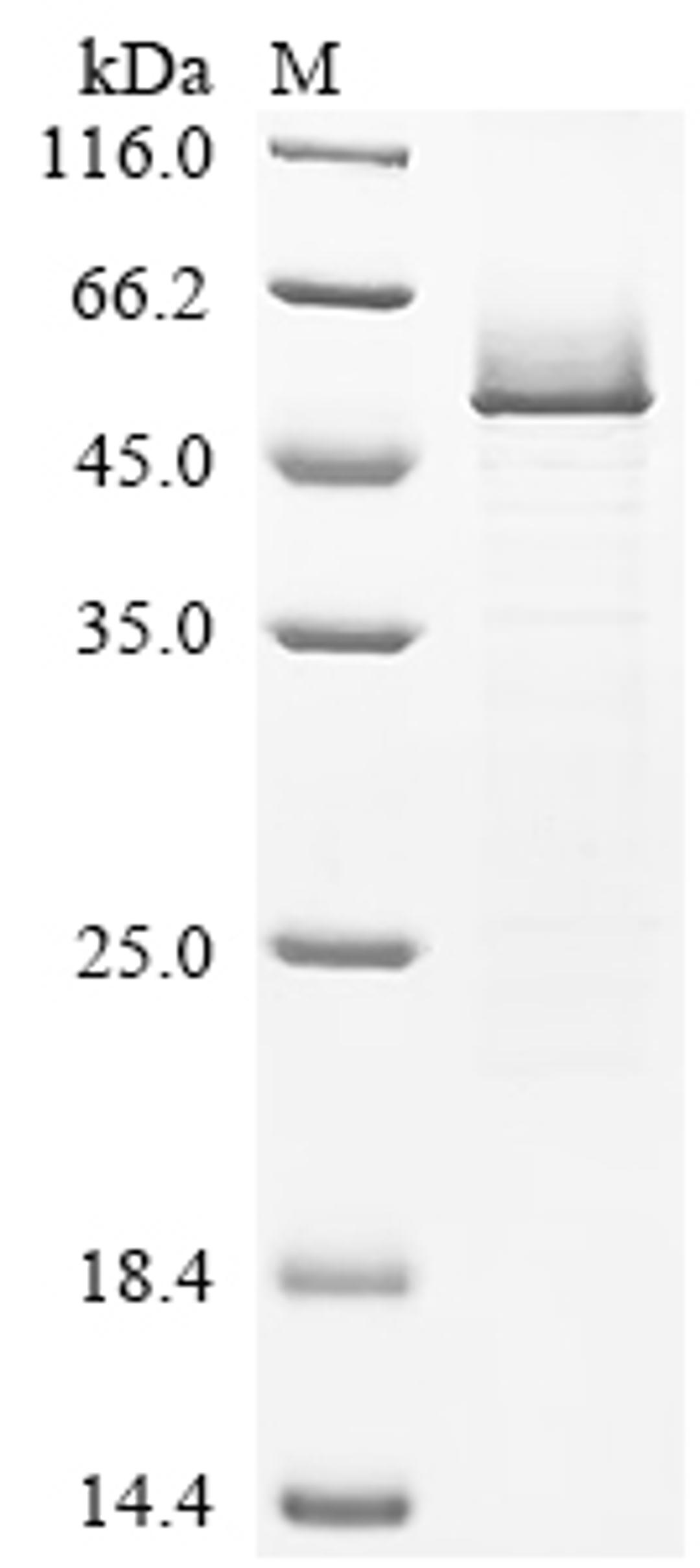 (Tris-Glycine gel) Discontinuous SDS-PAGE (reduced) with 5% enrichment gel and 15% separation gel.