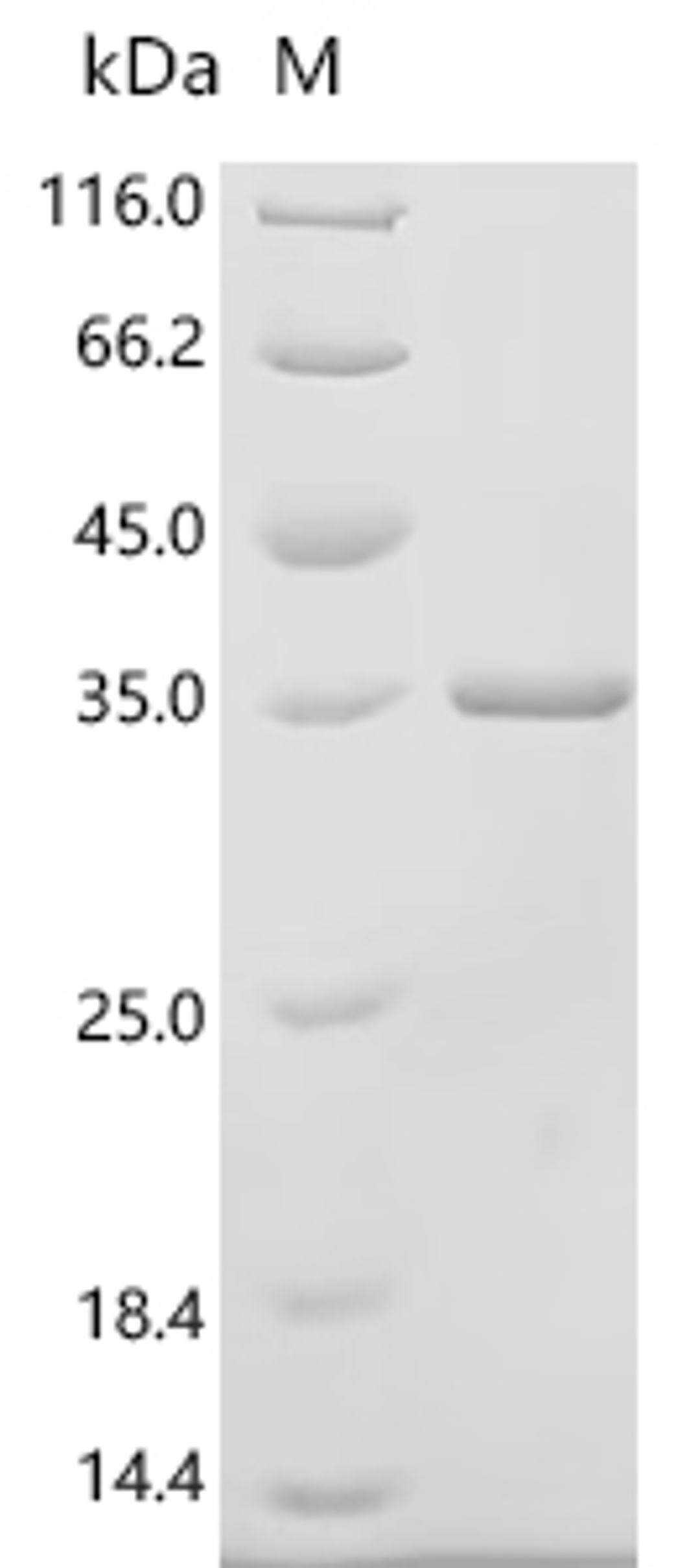 (Tris-Glycine gel) Discontinuous SDS-PAGE (reduced) with 5% enrichment gel and 15% separation gel.