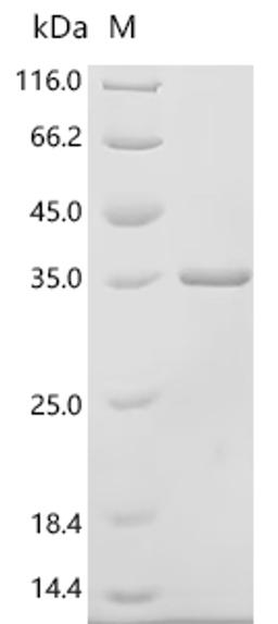(Tris-Glycine gel) Discontinuous SDS-PAGE (reduced) with 5% enrichment gel and 15% separation gel.