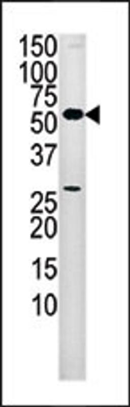 Western blot analysis of anti-PANK2 Pab in mouse liver tissue lysate (35ug/lane).