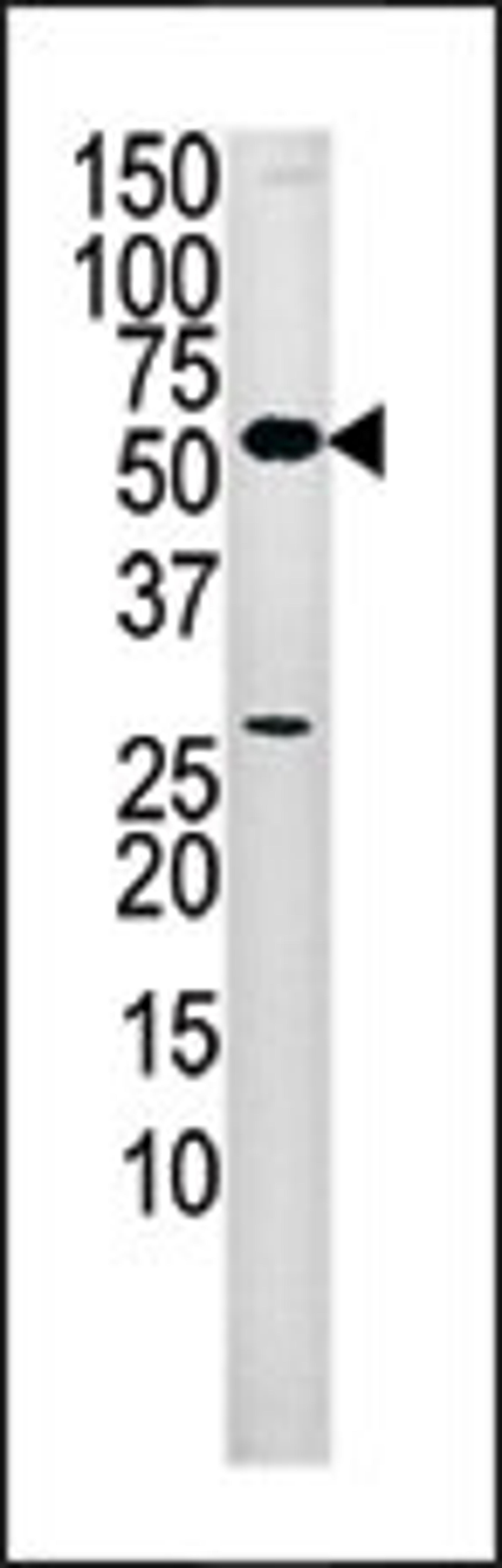 Western blot analysis of anti-PANK2 Pab in mouse liver tissue lysate (35ug/lane).