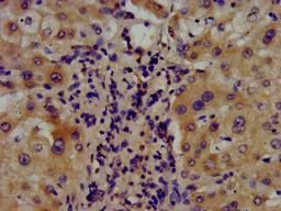 IHC image of CSB-PA002146LA01HU diluted at 1:400 and staining in paraffin-embedded human liver tissue performed on a Leica BondTM system. After dewaxing and hydration, antigen retrieval was mediated by high pressure in a citrate buffer (pH 6.0). Section was blocked with 10% normal goat serum 30min at RT. Then primary antibody (1% BSA) was incubated at 4°C overnight. The primary is detected by a biotinylated secondary antibody and visualized using an HRP conjugated SP system.