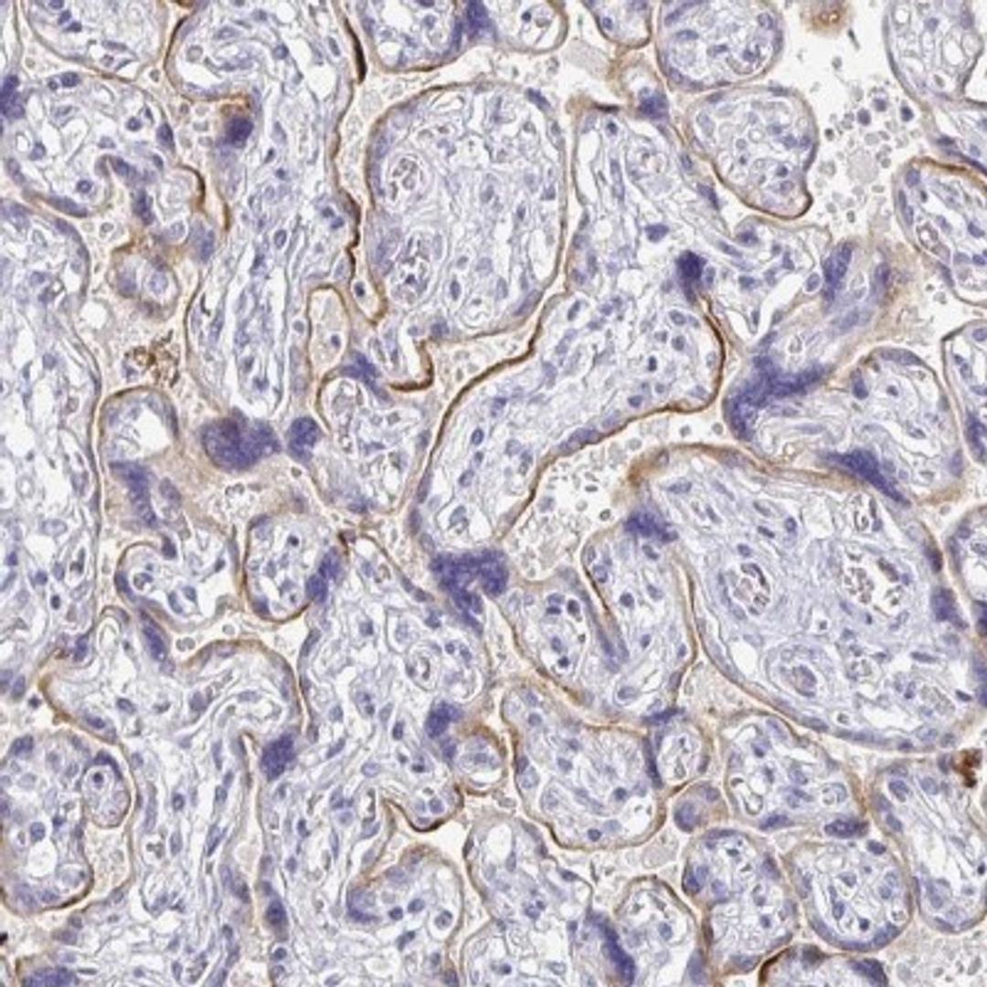 Immunohistochemistry: FKRP Antibody [NBP2-32543] - Staining of human placenta shows moderate cytoplasmic positivity in trophoblastic cells.