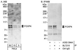 Detection of human FOXP4 by western blot and immunoprecipitation.