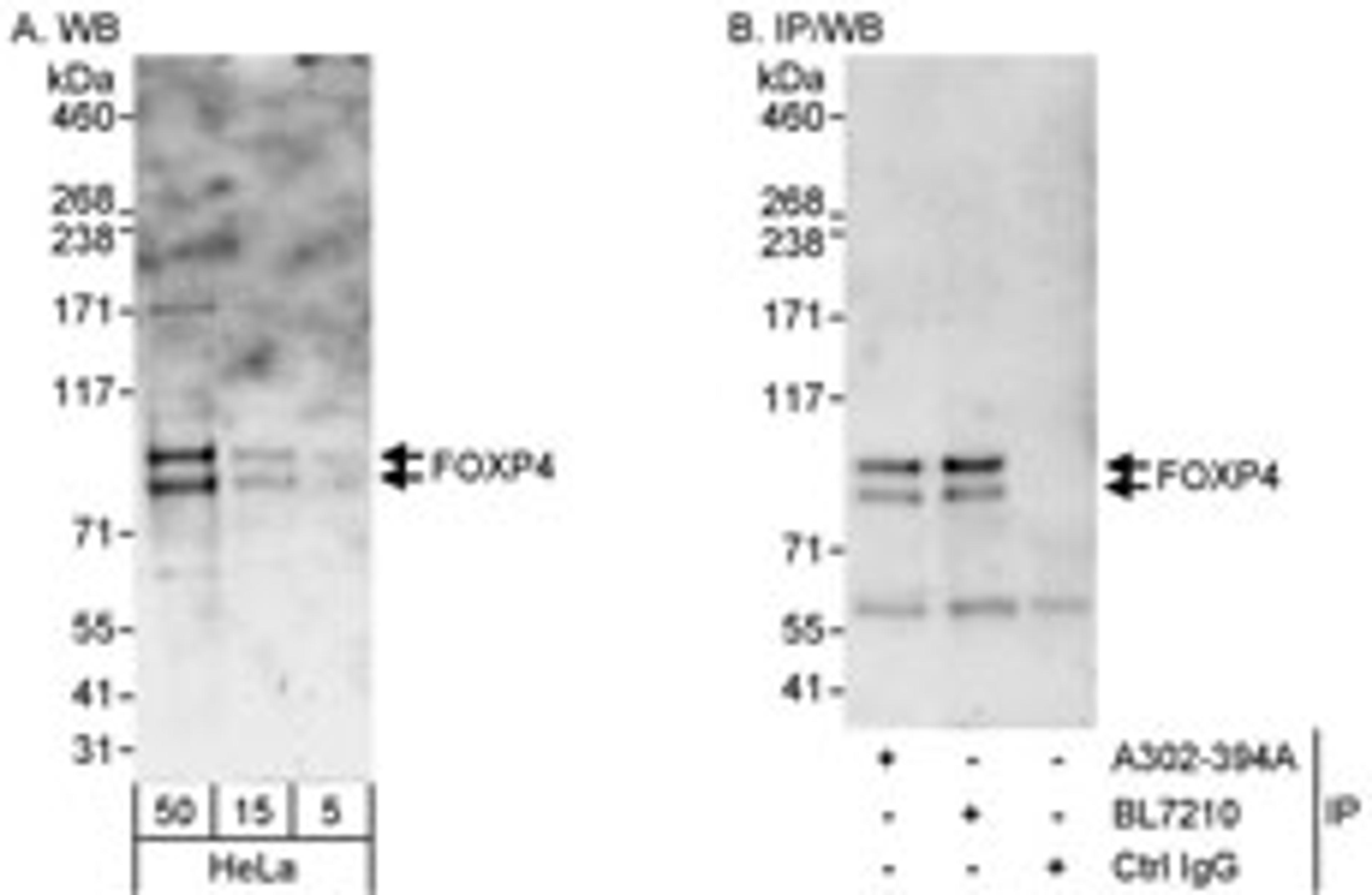 Detection of human FOXP4 by western blot and immunoprecipitation.