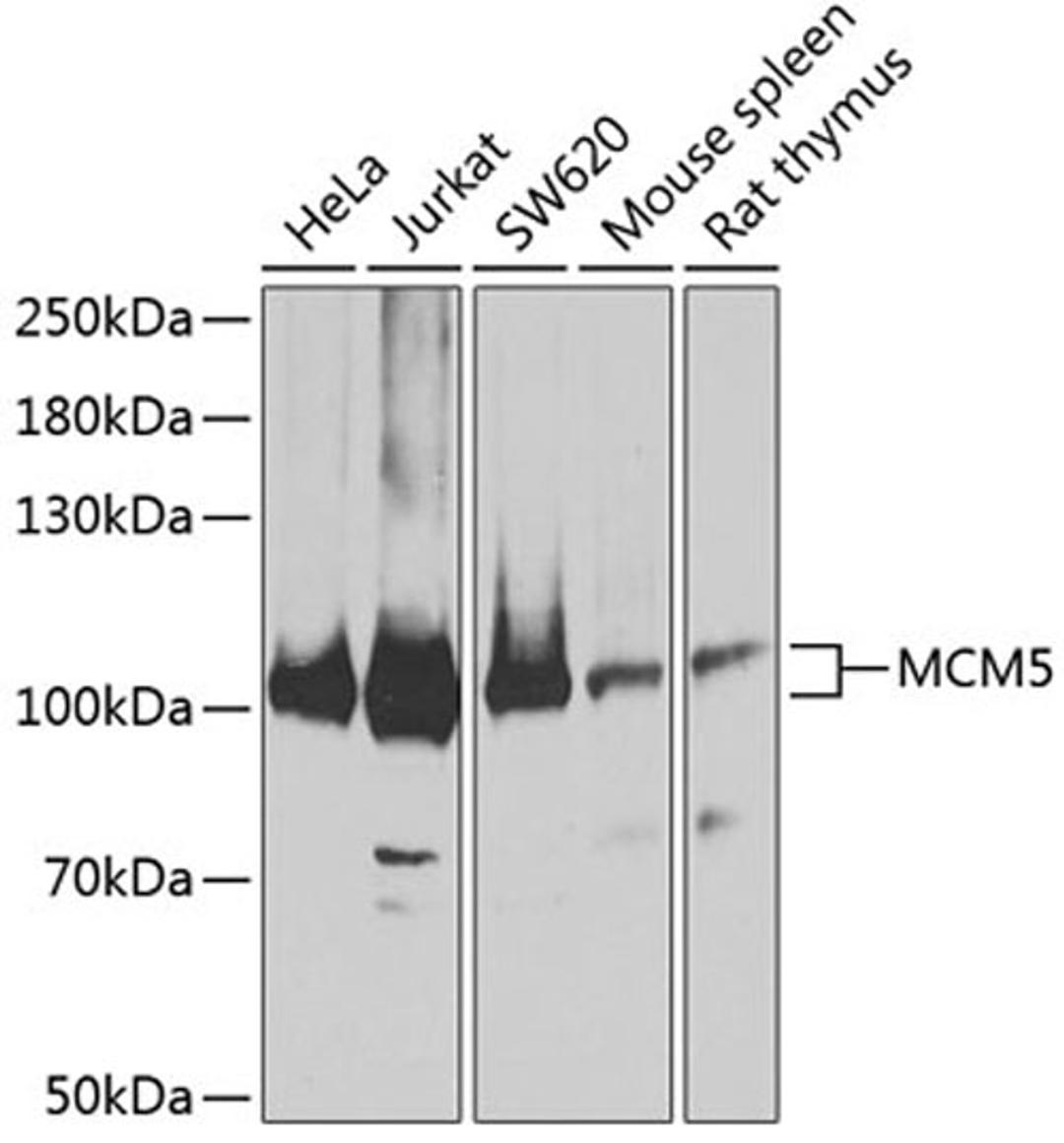 Western blot - MCM5 antibody (A5556)