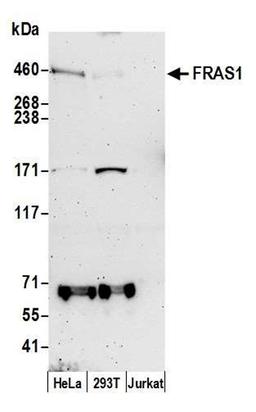 Detection of human FRAS1 by WB.