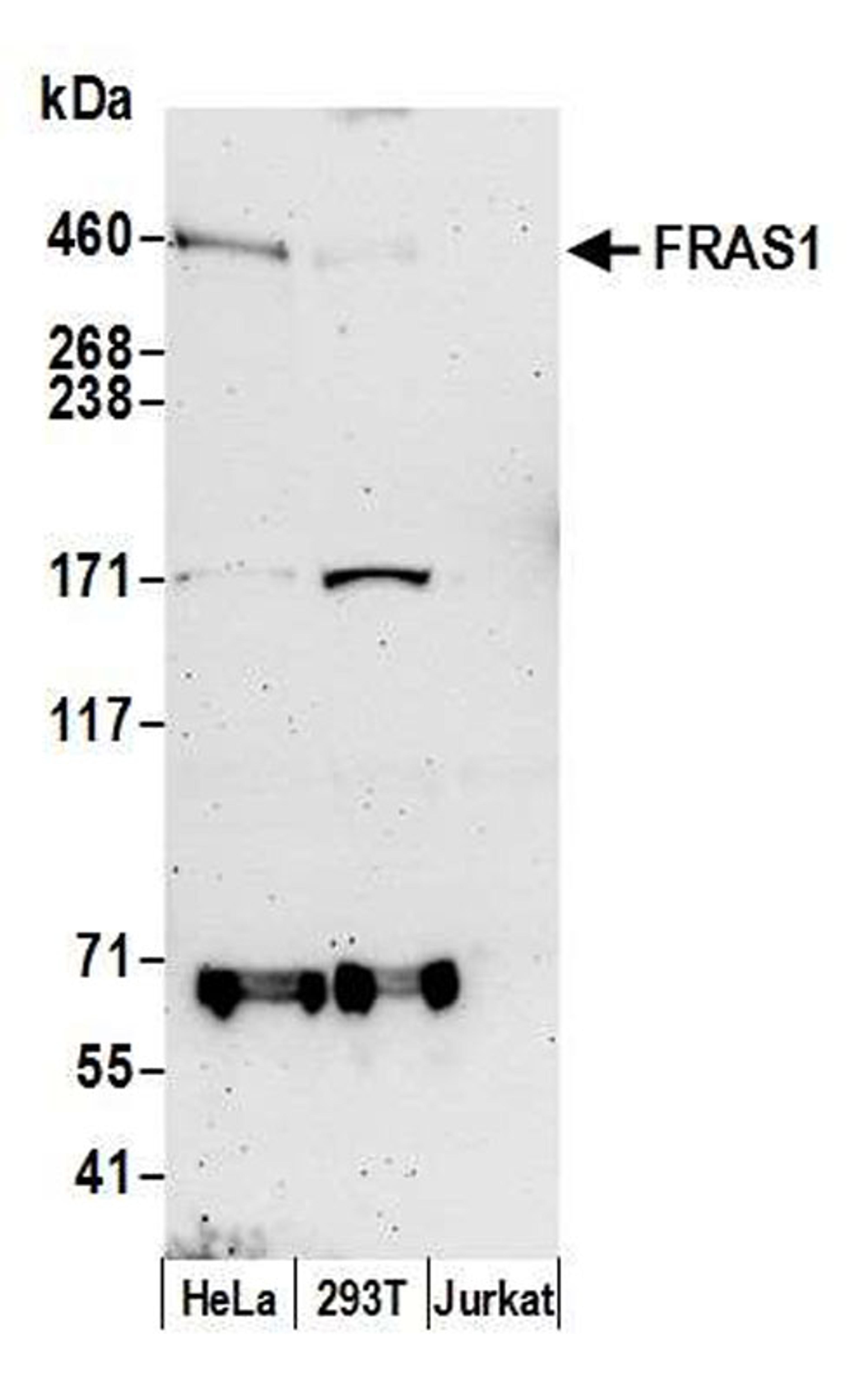 Detection of human FRAS1 by WB.