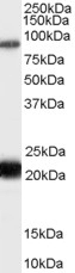 46-269 (0.3ug/ml) staining of Human Thyroid lysate (35ug protein in RIPA buffer). Primary incubation was 1 hour. Detected by chemiluminescence.