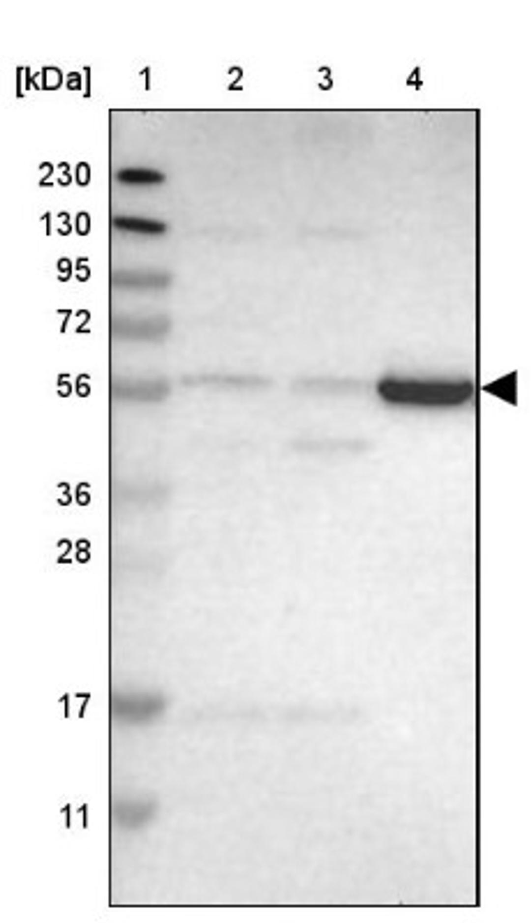 Western Blot: HIATL1 Antibody [NBP1-82223] - Lane 1: Marker [kDa] 230, 130, 95, 72, 56, 36, 28, 17, 11<br/>Lane 2: Human cell line RT-4<br/>Lane 3: Human cell line U-251MG sp<br/>Lane 4: Human plasma (IgG/HSA depleted)