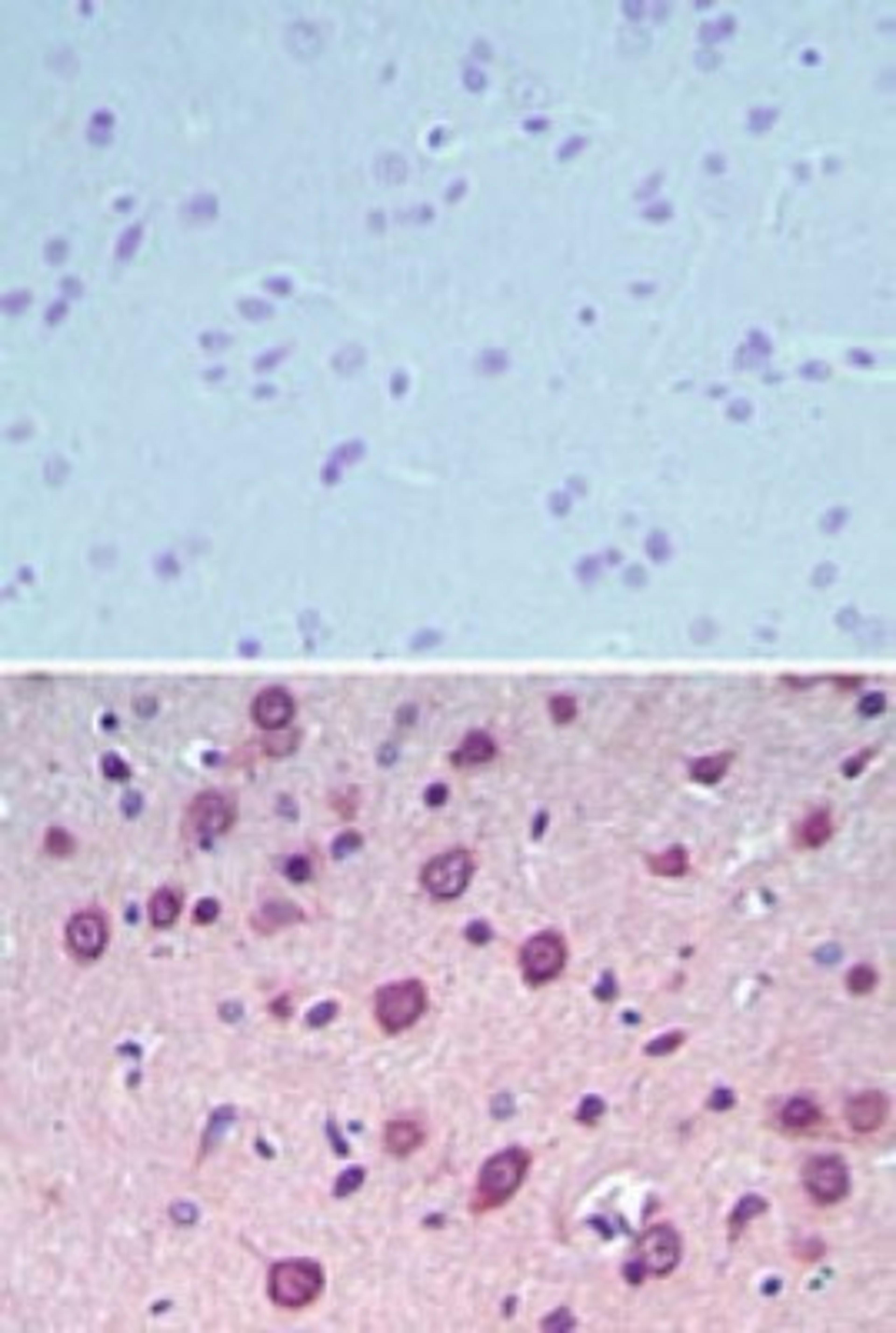 Immunohistochemistry-Paraffin: UCP4 Antibody [NBP2-24562] - analysis of UCP4 in paraffin-embedded formalin-fixed rat brain tissue using an isotype control antibody (top) and UCP4 antibody (bottom) at 5 ug/ml.