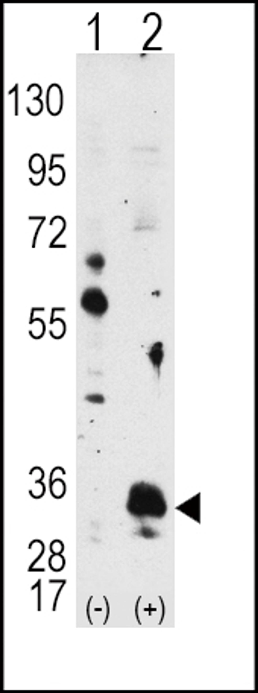 Western blot analysis of PIM1 using PIM1 Antibody using 293 cell lysates (2 ug/lane) either nontransfected (Lane 1) or transiently transfected with the PIM1 gene (Lane 2).