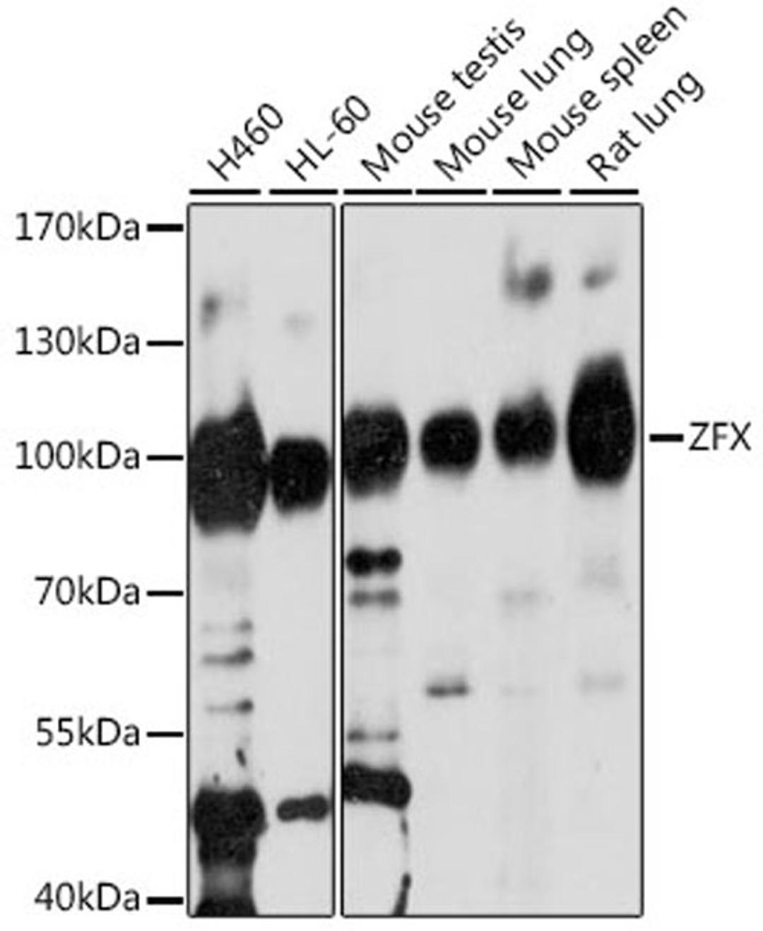 Western blot - ZFX antibody (A16444)