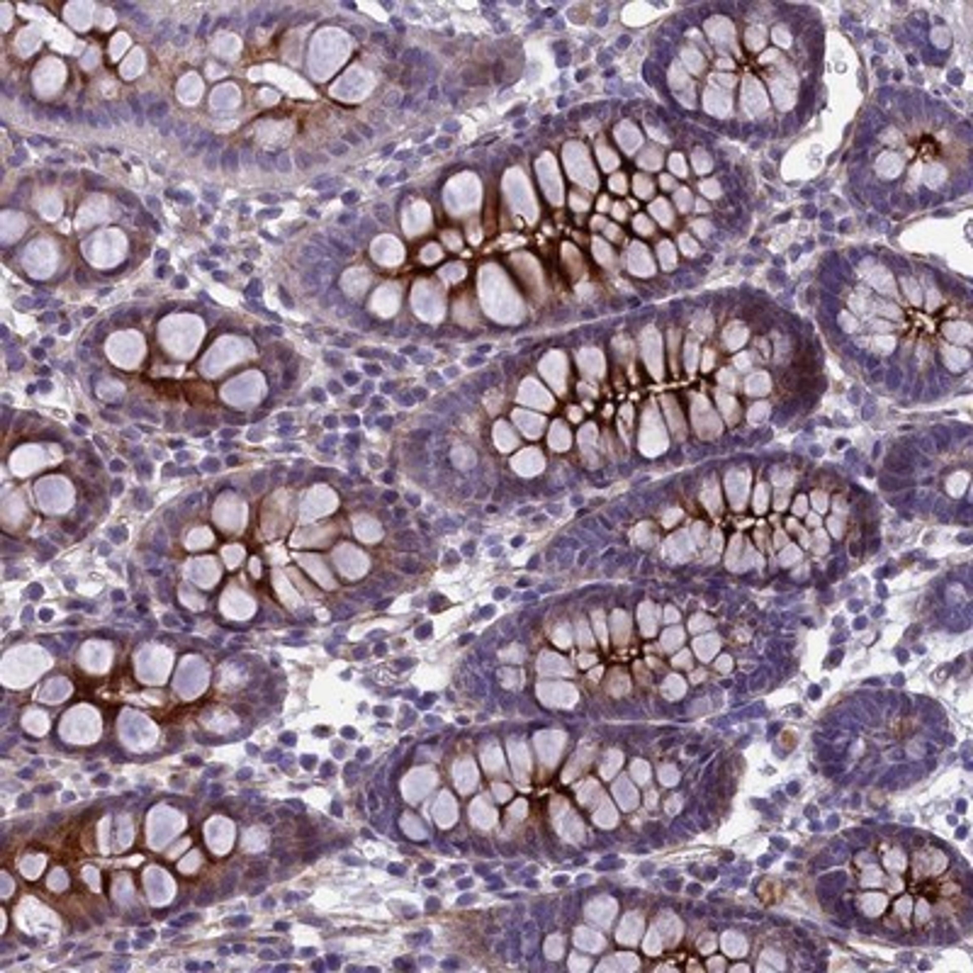 Immunohistochemistry-Paraffin: LOXL1 Antibody [NBP1-82827] - Staining of human colon shows strong cytoplasmic positivity in glandular cells.