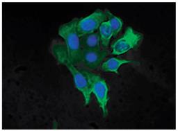 Human pancreatic carcinoma cell line MIA PaCa-2 was stained with Mouse Anti-Cytokeratin 8-FITC (Cat. No. 99-626).