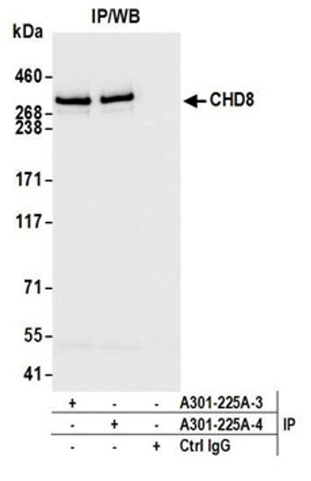 Detection of human CHD8 by western blot of immunoprecipitates.