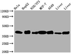 Western Blot. Positive WB detected in: Hela whole cell lysate, HepG2 whole cell lysate, NIH/3T3 whole cell lysate, A549 whole cell lysate, Mouse Liver whole cell lysate, Rat Liver whole cell lysate. All lanes: Aldolase antibody at 1:1000. Secondary. Goat polyclonal to rabbit IgG at 1/50000 dilution. Predicted band size: 40, 46 kDa. Observed band size: 40 kDa. 