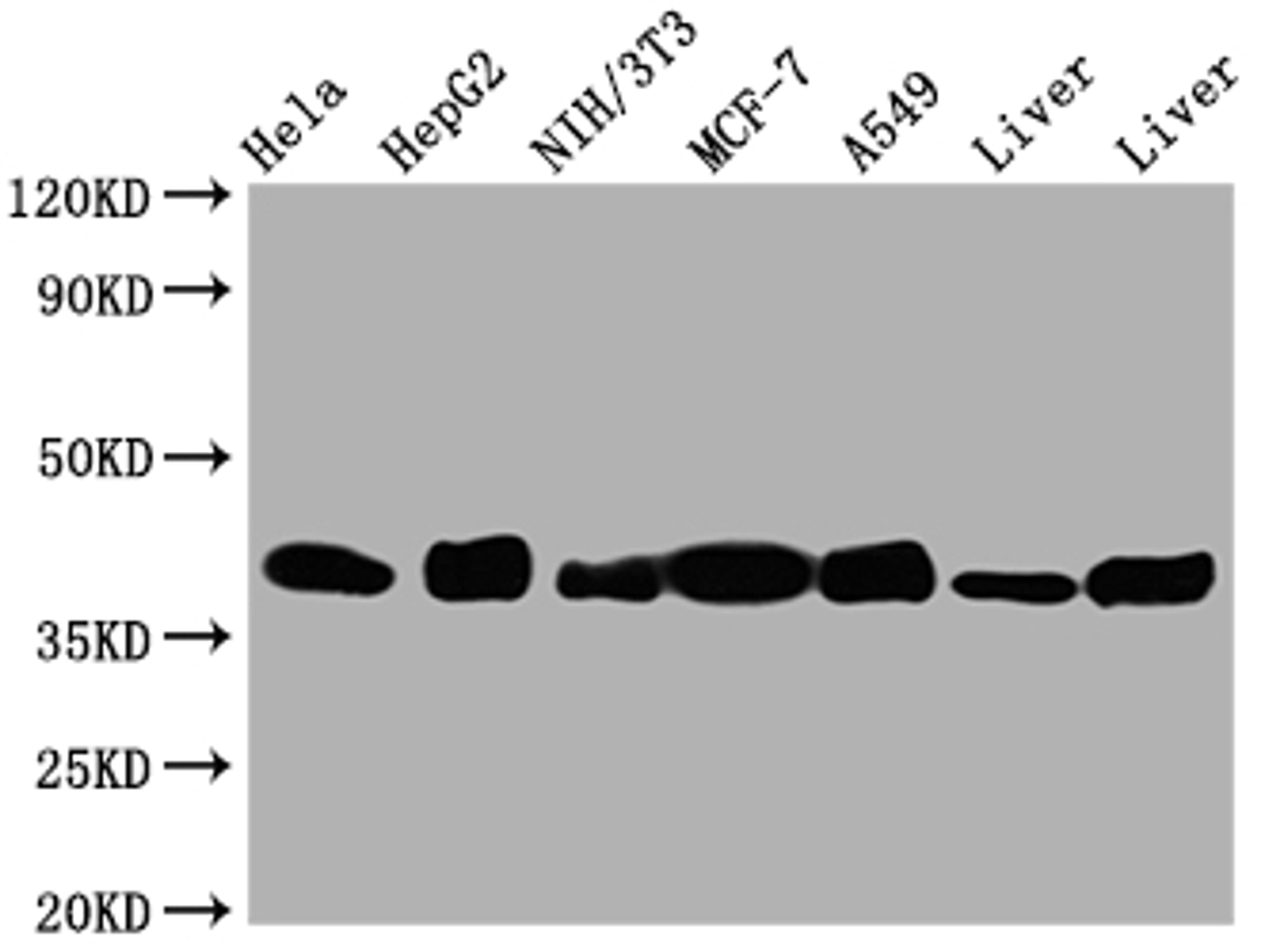 Western Blot. Positive WB detected in: Hela whole cell lysate, HepG2 whole cell lysate, NIH/3T3 whole cell lysate, A549 whole cell lysate, Mouse Liver whole cell lysate, Rat Liver whole cell lysate. All lanes: Aldolase antibody at 1:1000. Secondary. Goat polyclonal to rabbit IgG at 1/50000 dilution. Predicted band size: 40, 46 kDa. Observed band size: 40 kDa. 