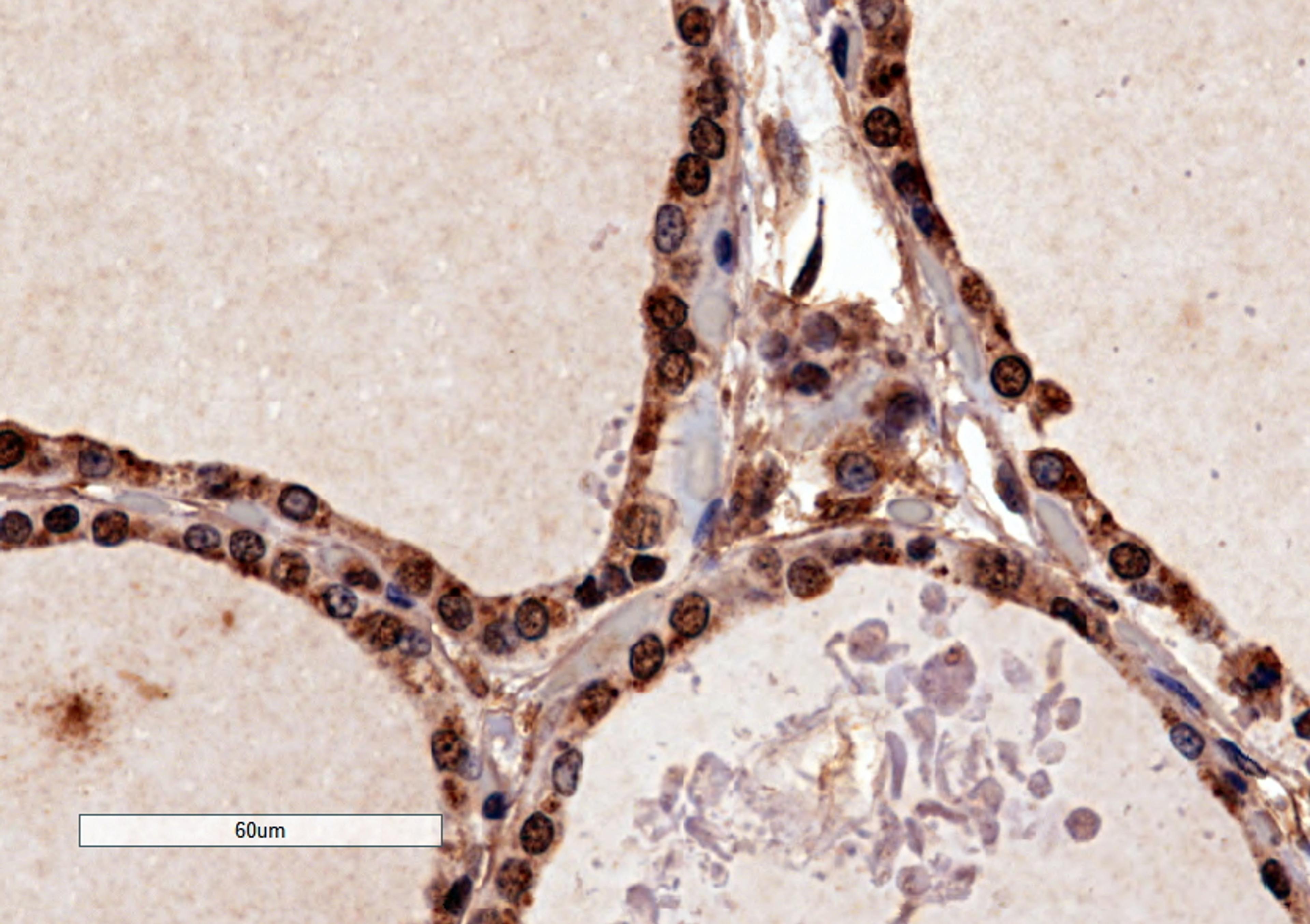 46-141 (4ug/ml) staining of paraffin embedded Human Thyroid Gland. Microwaved antigen retrieval with citrate buffer pH 6, HRP-staining.