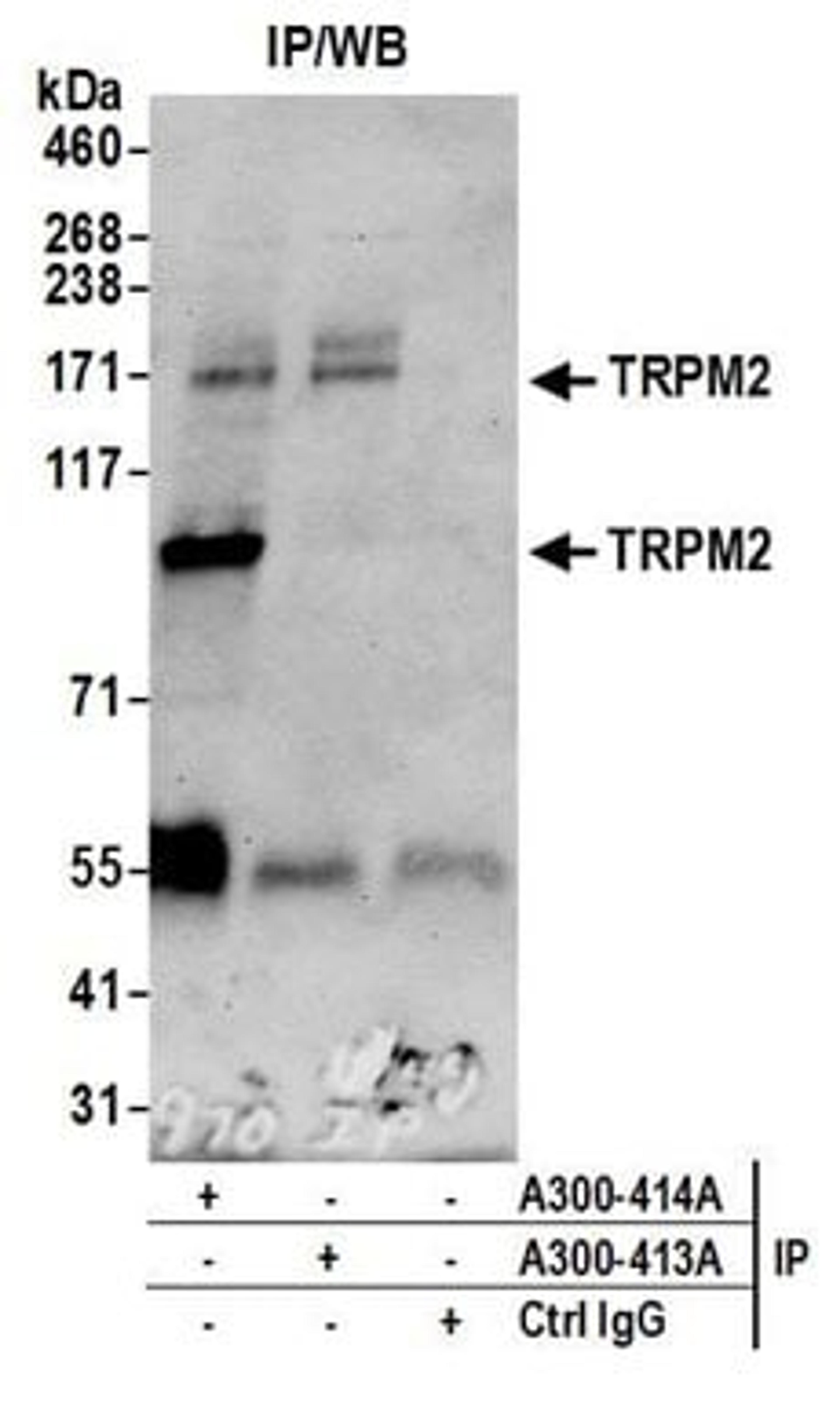 Detection of human TRPM2 by western blot of immunoprecipitates.