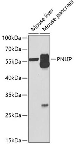 Western blot - PNLIP antibody (A6396)