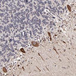 Immunohistochemistry: MAPK15 Antibody [NBP1-84804] - Staining of human cerebellum shows cytoplasmic positivity in purkinje cells.