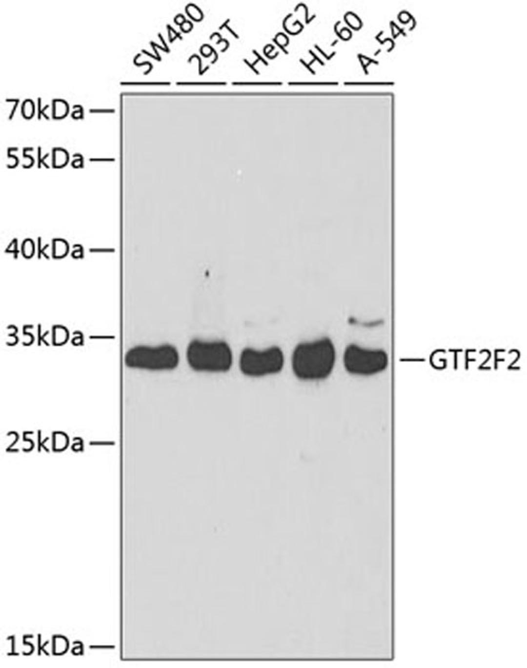 Western blot - GTF2F2 antibody (A5826)