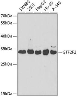 Western blot - GTF2F2 antibody (A5826)