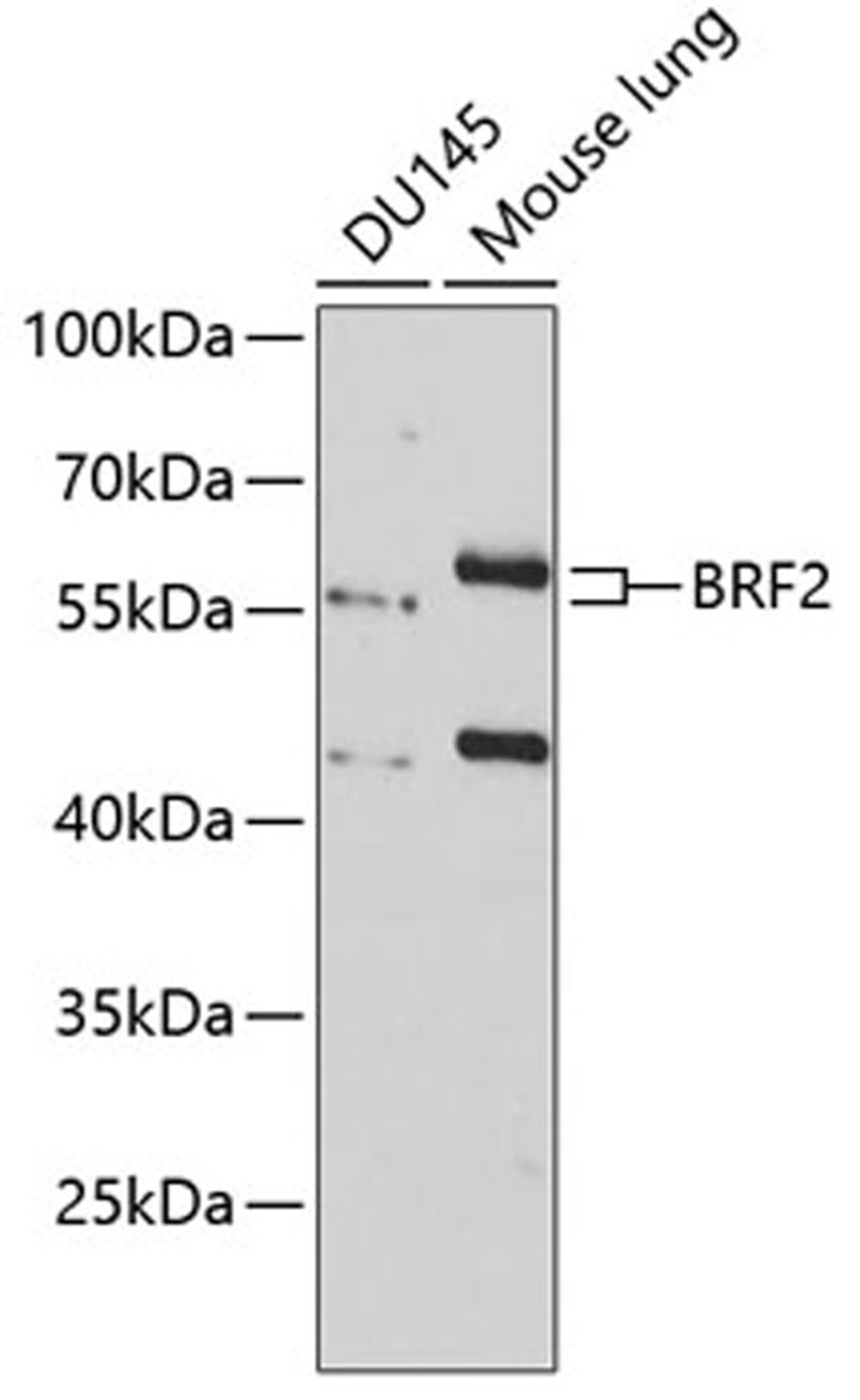 Western blot - BRF2 antibody (A8782)