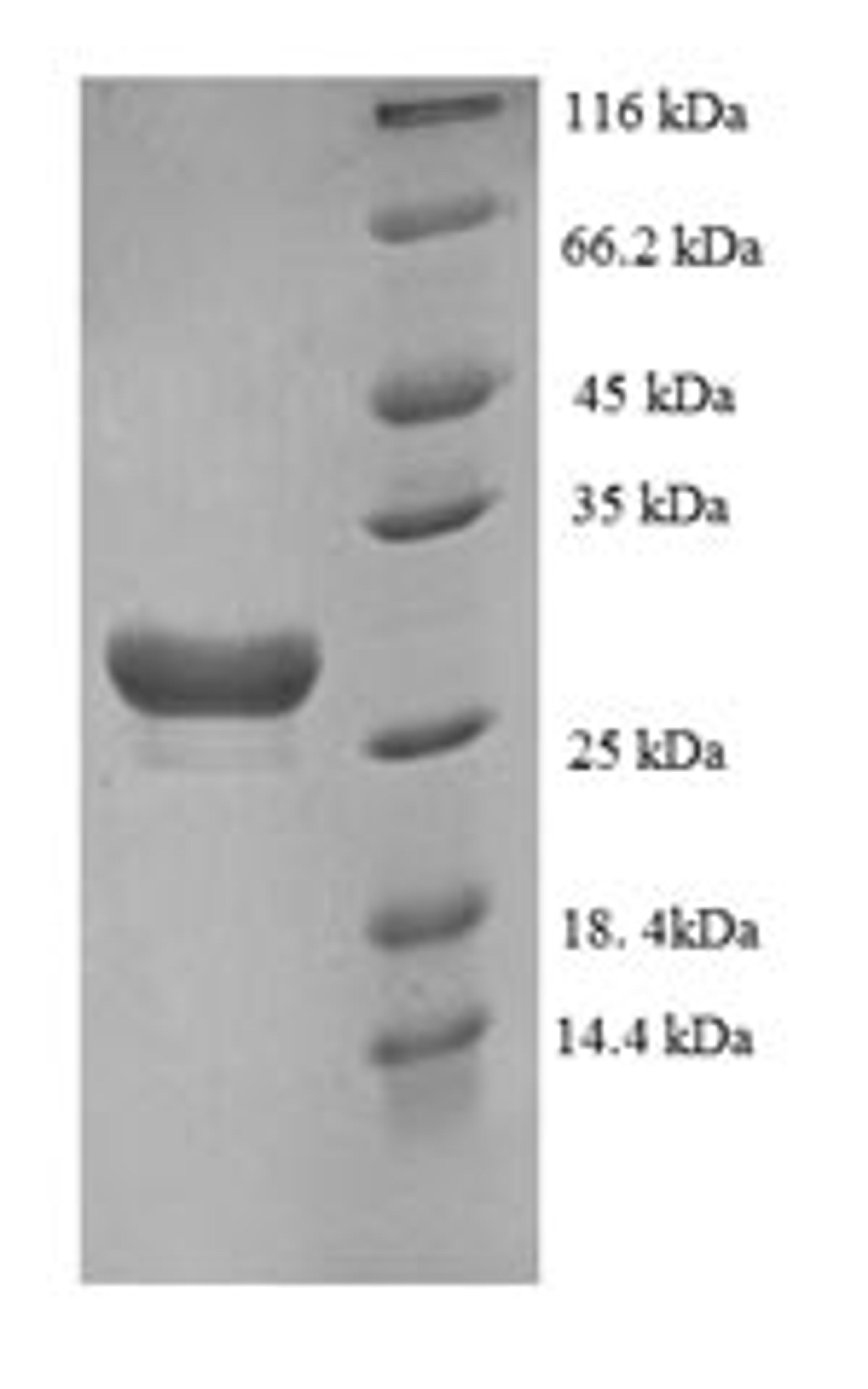 (Tris-Glycine gel) Discontinuous SDS-PAGE (reduced) with 5% enrichment gel and 15% separation gel.