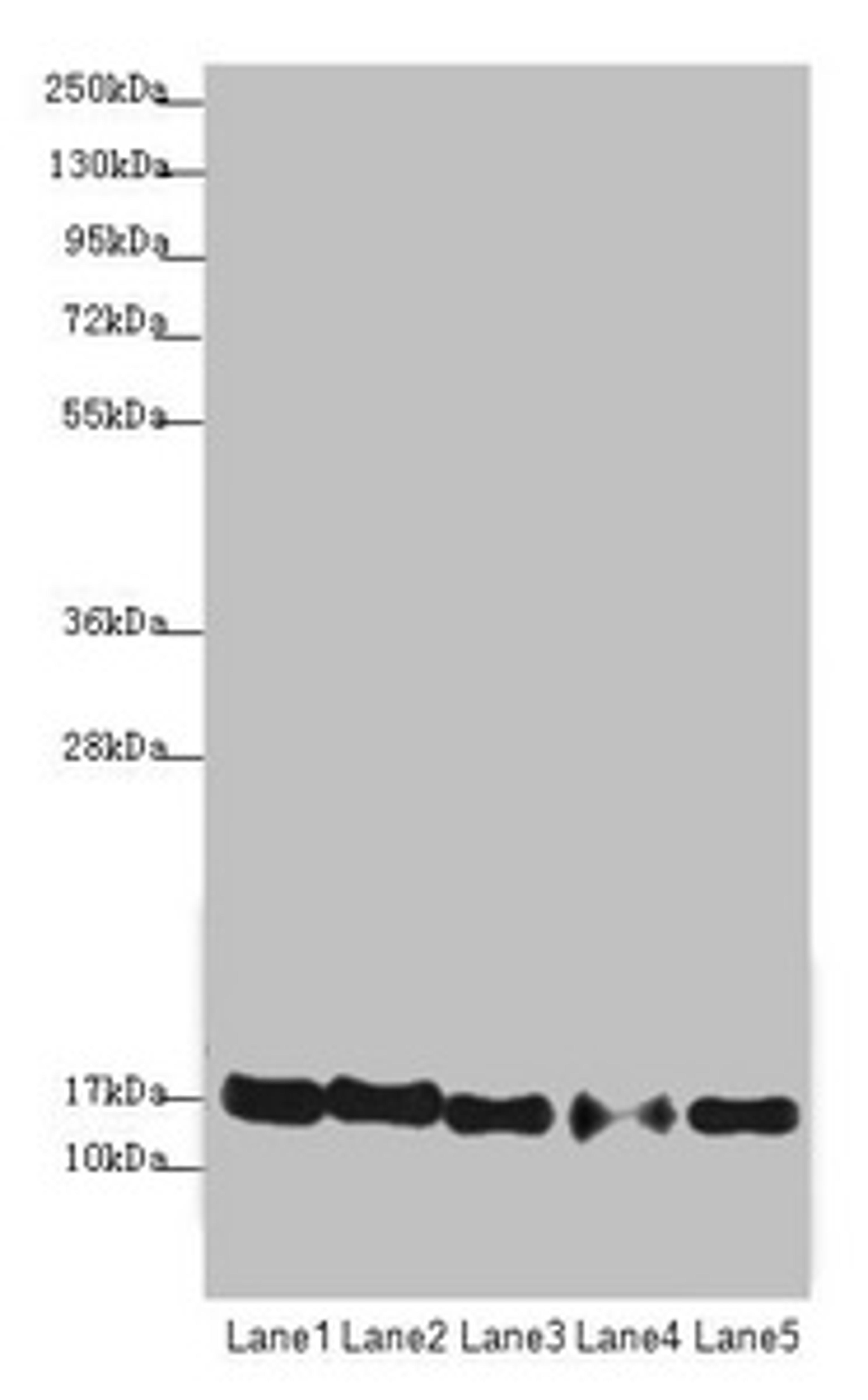 Western blot. All lanes: ATP5F1D antibody at 1.94µg/ml. Lane 1: Raji whole cell lysate. Lane 2: NIH/3T3 whole cell lysate. Lane 3: A549 whole cell lysate. Lane 4: MDA-MB-231 whole cell lysate. Lane 5: HepG2 whole cell lysate. Secondary. Goat polyclonal to rabbit IgG at 1/10000 dilution. Predicted band size: 18 kDa. Observed band size: 18 kDa