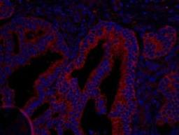 Detection of human Coronin 2 by immunohistochemistry.