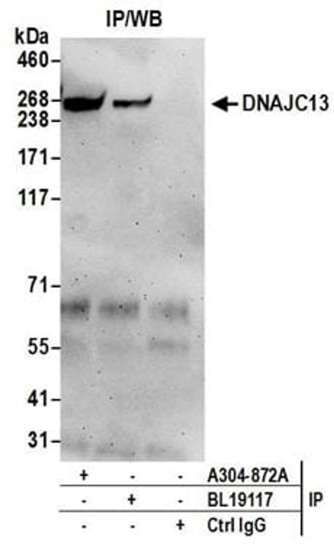 Detection of human DNAJC13 by western blot of immunoprecipitates.