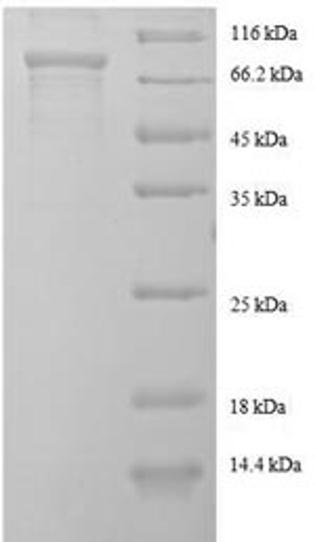 (Tris-Glycine gel) Discontinuous SDS-PAGE (reduced) with 5% enrichment gel and 15% separation gel.