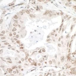 Detection of human LEDGF/p75 by immunohistochemistry.