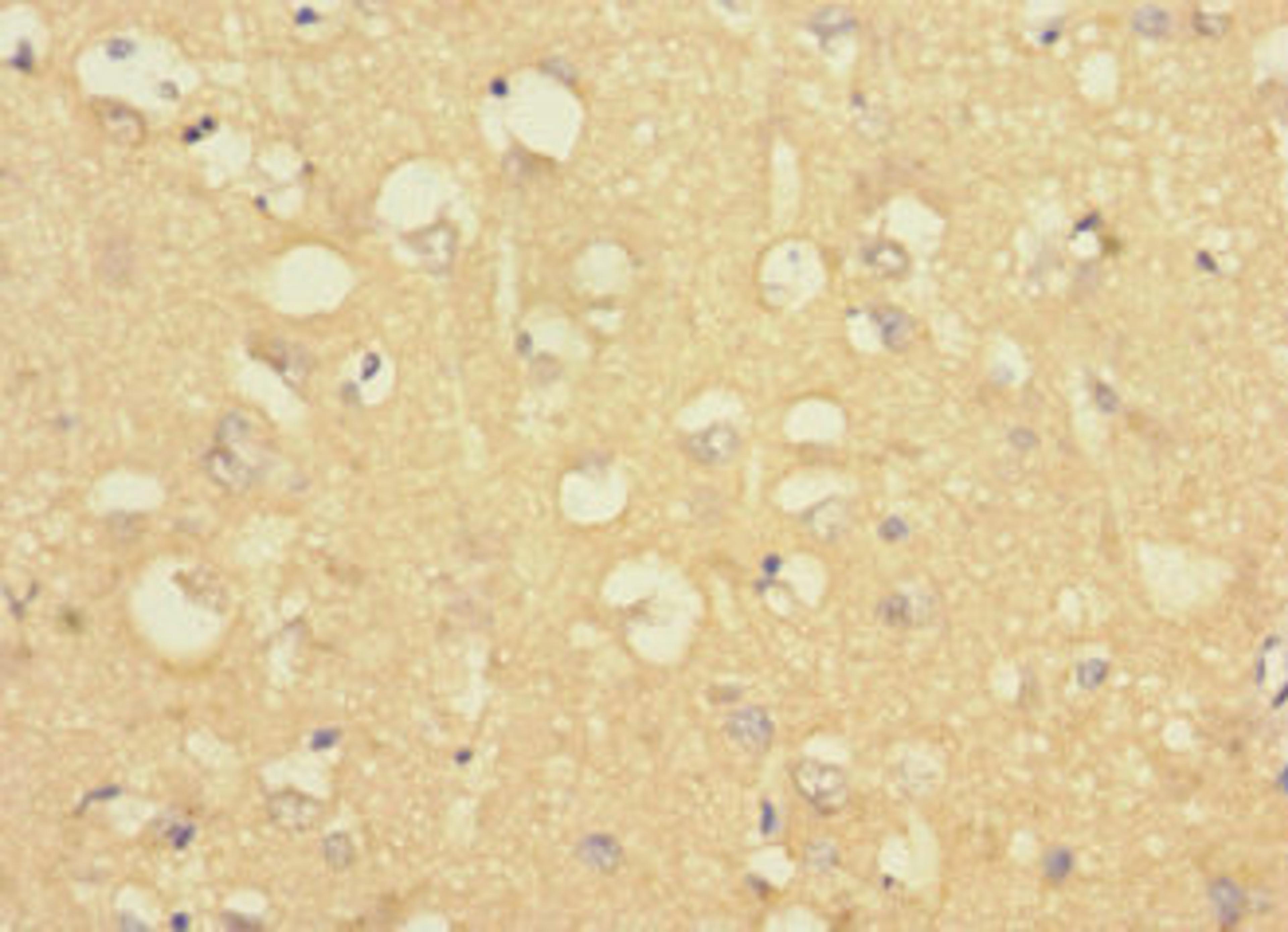 Immunohistochemistry of paraffin-embedded human brain tissue using CSB-PA888027LA01HU at dilution of 1:100