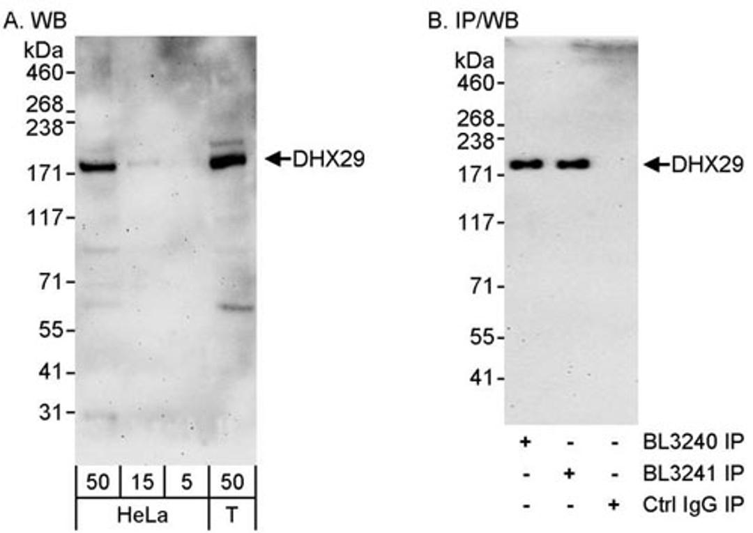 Detection of human DHX29 by WB and IP.