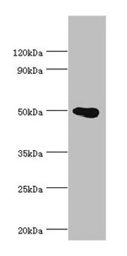 Western blot. All lanes: PRMT2 antibody at 4µg/ml + HL60 whole cell lysate. Secondary. Goat polyclonal to rabbit IgG at 1/10000 dilution. Predicted band size: 50, 32, 38, 33, 34, 26, 32 kDa. Observed band size: 50 kDa