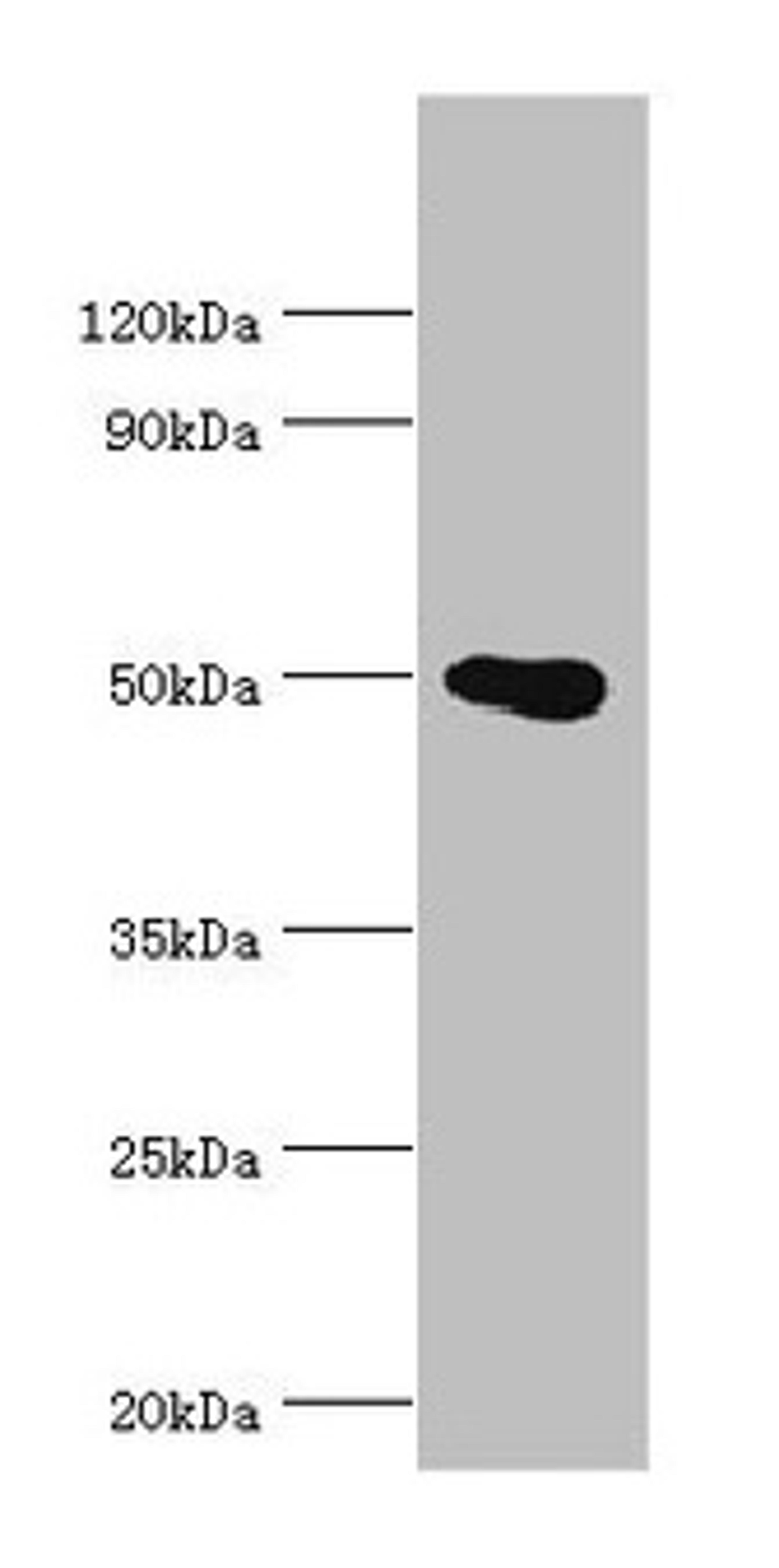 Western blot. All lanes: PRMT2 antibody at 4µg/ml + HL60 whole cell lysate. Secondary. Goat polyclonal to rabbit IgG at 1/10000 dilution. Predicted band size: 50, 32, 38, 33, 34, 26, 32 kDa. Observed band size: 50 kDa