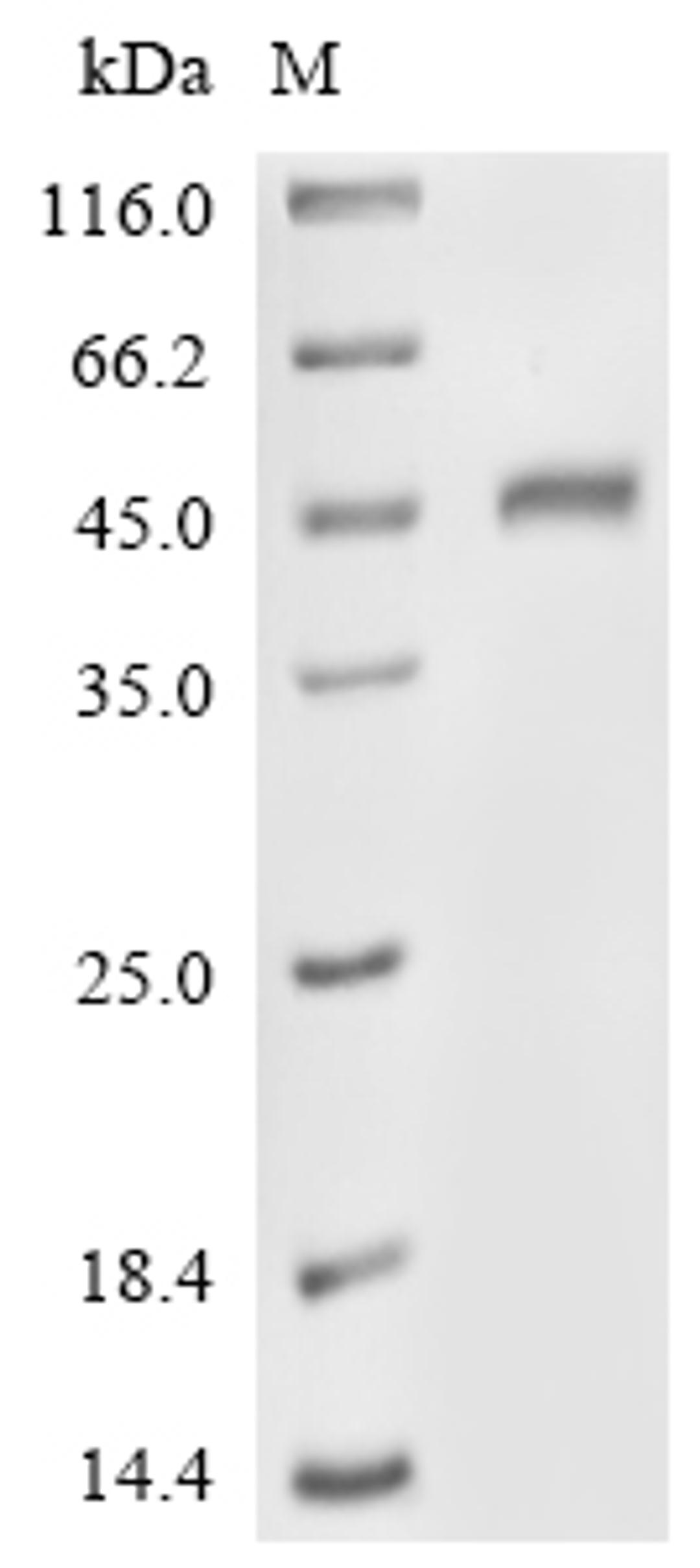 (Tris-Glycine gel) Discontinuous SDS-PAGE (reduced) with 5% enrichment gel and 15% separation gel.