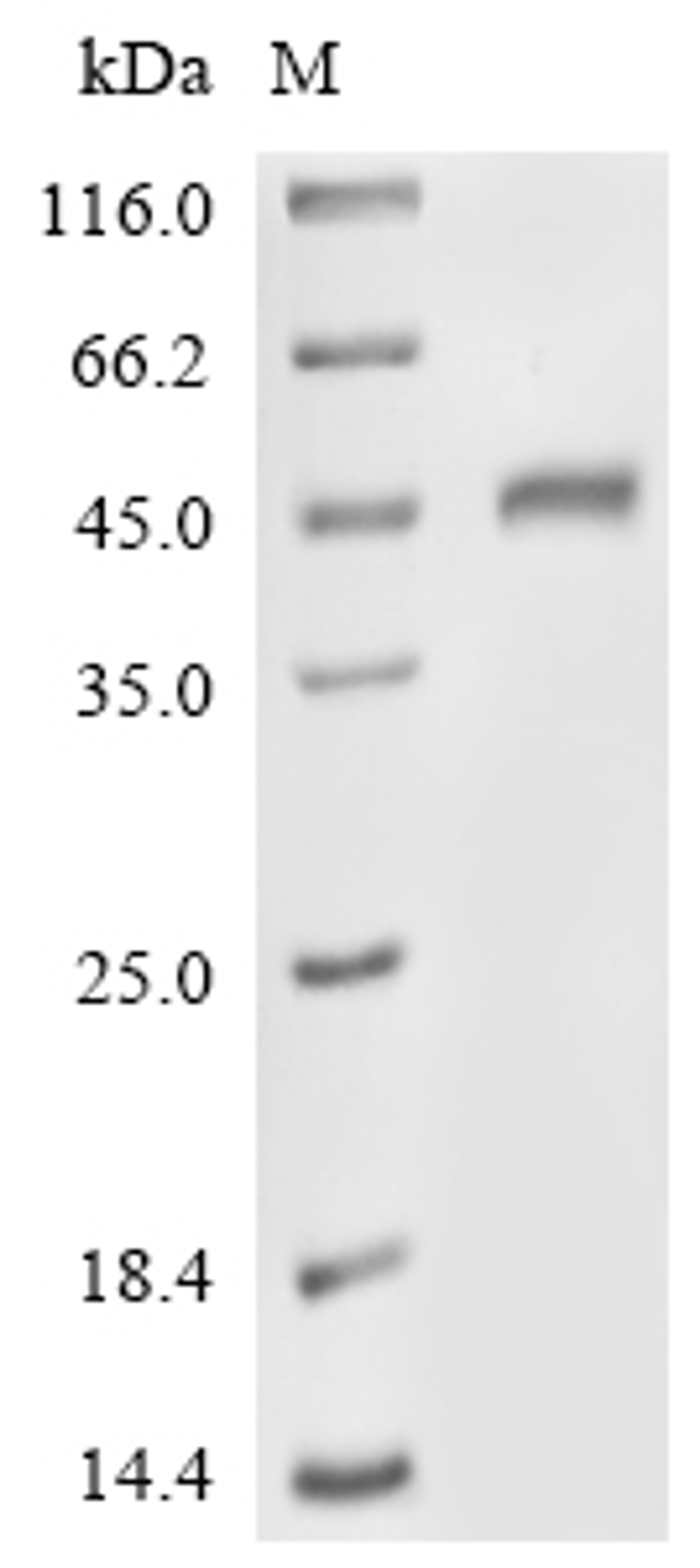 (Tris-Glycine gel) Discontinuous SDS-PAGE (reduced) with 5% enrichment gel and 15% separation gel.
