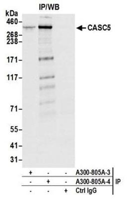 Detection of human CASC5 by western blot of immunoprecipitates.