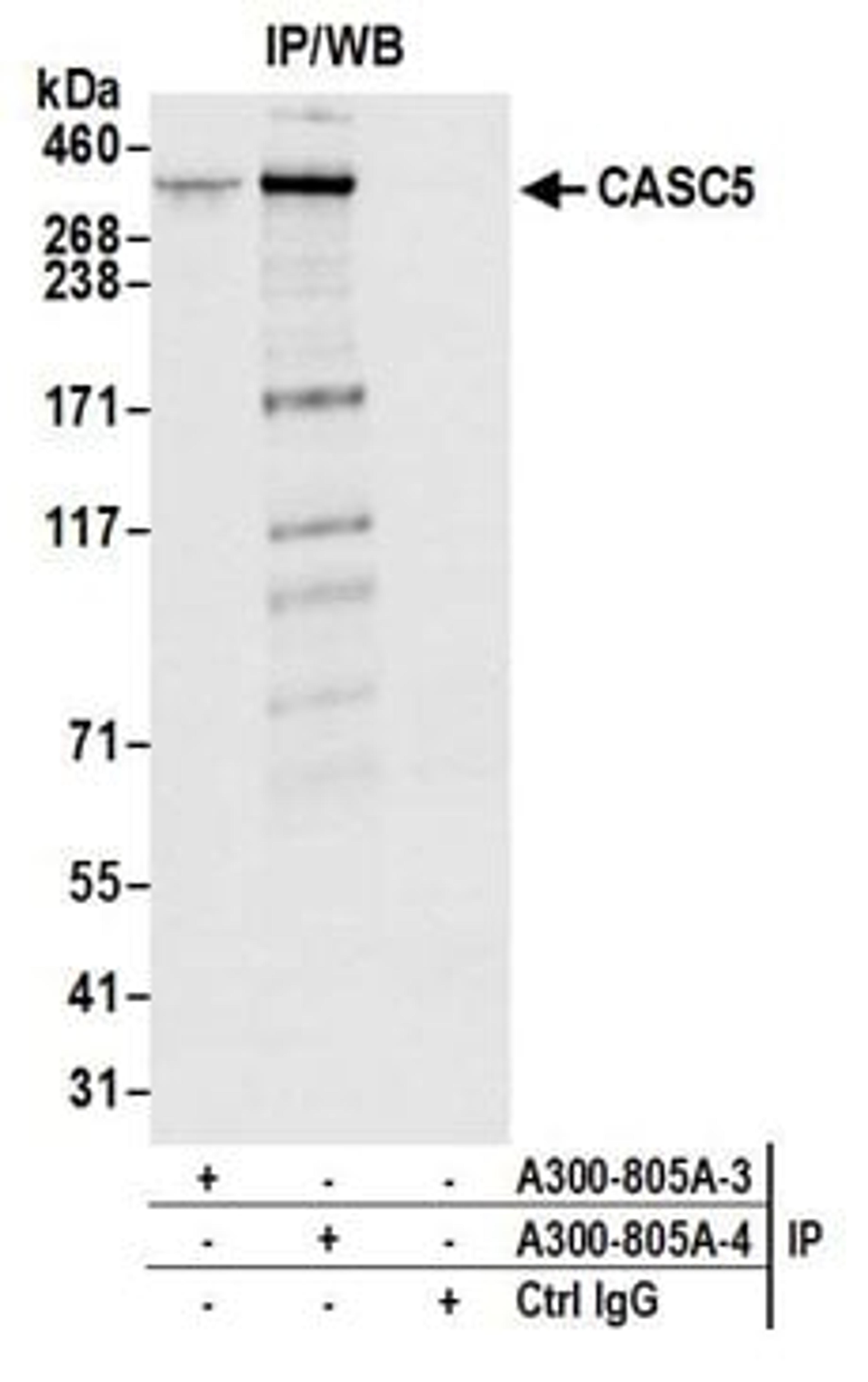 Detection of human CASC5 by western blot of immunoprecipitates.